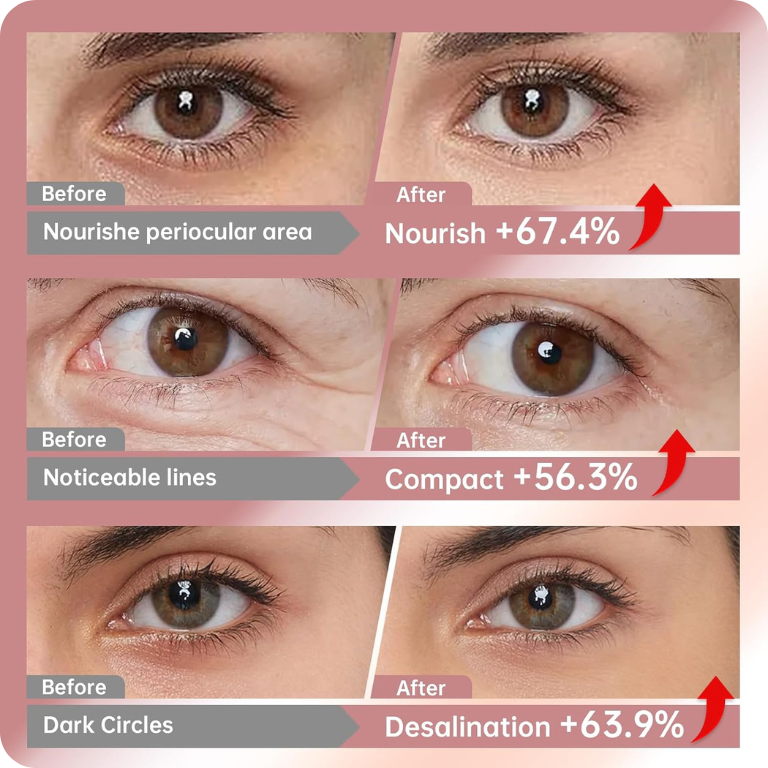 Bio-Collagen Eye Patches