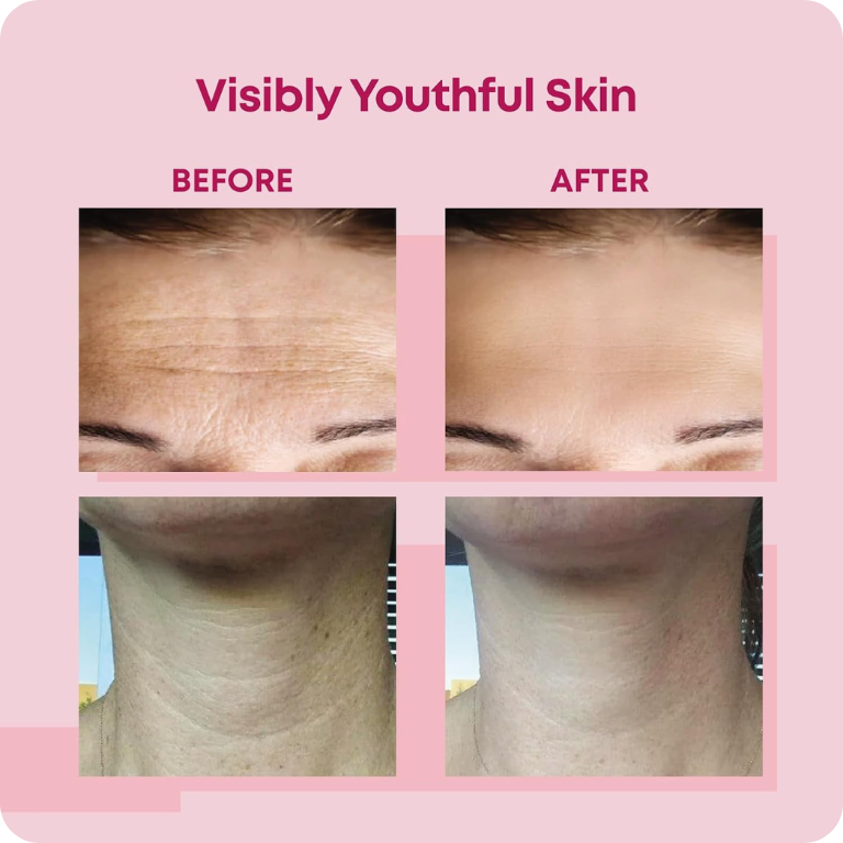 Bio-Collagen Neck Patches