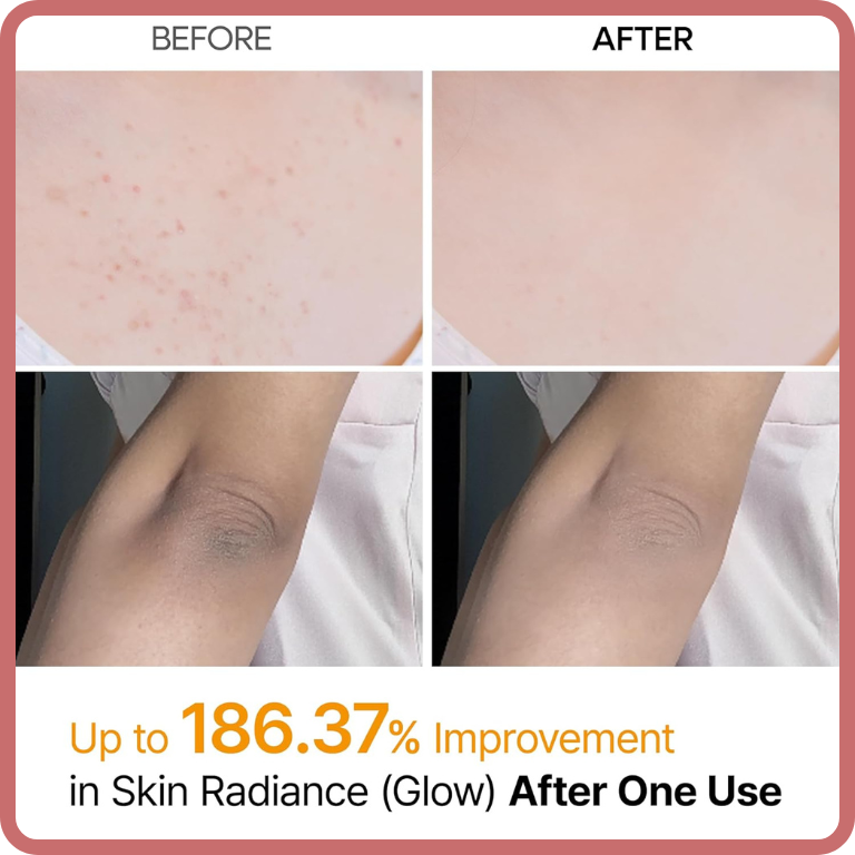 Peel Shot - Kojic + Turmeric Body Peel Spray