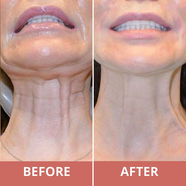 Watch Your Skin Transform Week by Week