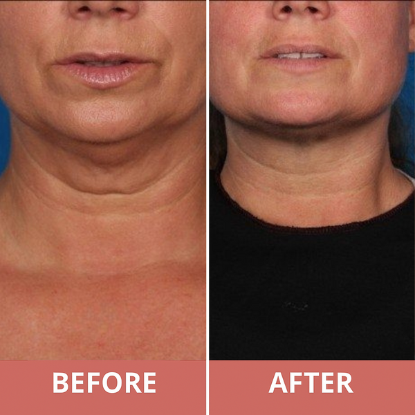 Watch Your Skin Transform Week by Week